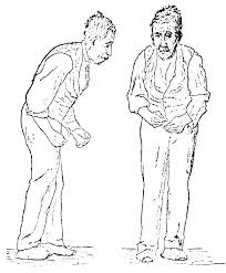 Meth Addiction and Parkinson's